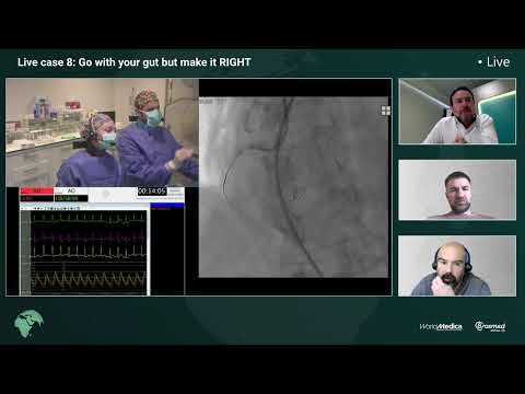 Live Case | Combating Severe Calcification RCA CTO on CTO LIVE AID 2024