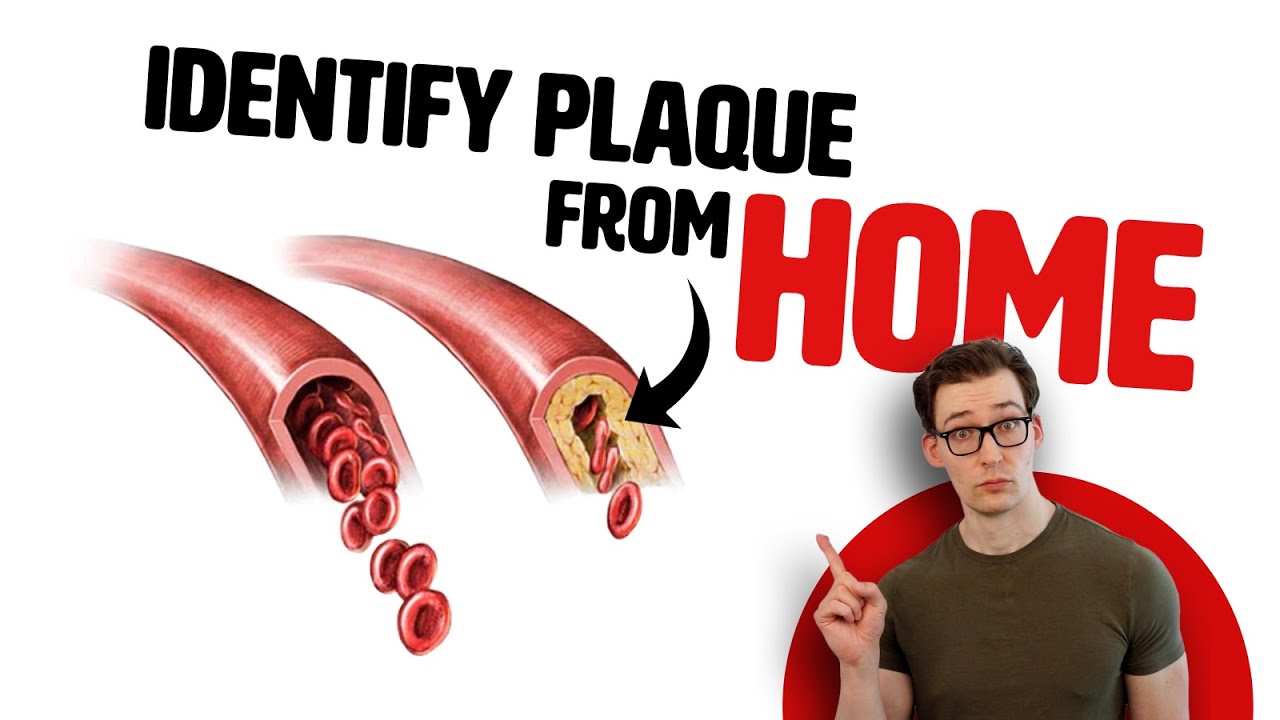 An Easy, At Home Test to Find Plaque in your Arteries