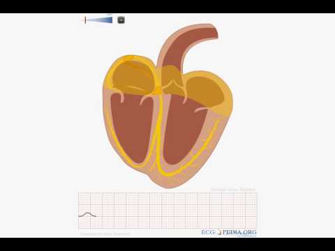 Animation of normal sinus rhythm