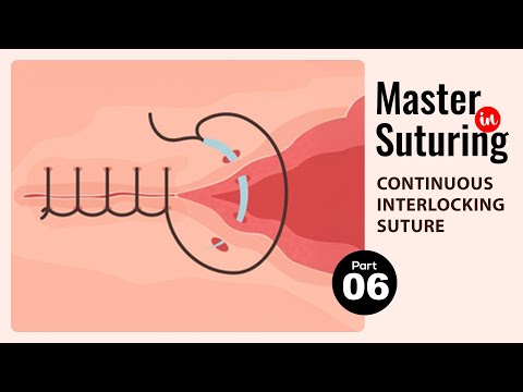 Continuous Interlocking Suture Like a Pro – Learn Suturing Technique