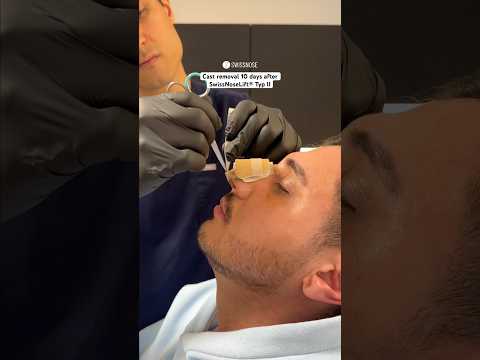 Cast removal | Dr. med. Simon Zimmermann