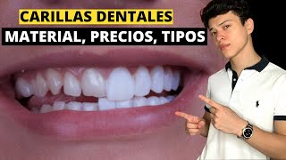 LO QUE DEBES SABER ANTES DE PONERTE CARILLAS DENTALES (MATERIAL, COSTO, TIPOS DE CARILLAS DENTALES)
