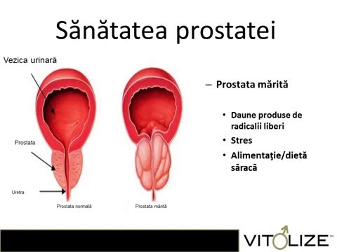 Ist Prostata gefährlich für Männer Die Behandlung von Weizensprossen Prostatakrebs