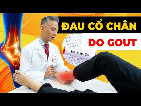 Bí Quyết Giảm Đau Do Gout Hành Hạ – Khám Phá Cách Làm Hiệu Quả!