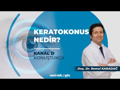 KERATOKONUS NEDİR? | DOÇ. DR. REMZİ KARADAĞ | KANAL D, KONUŞTUKÇA