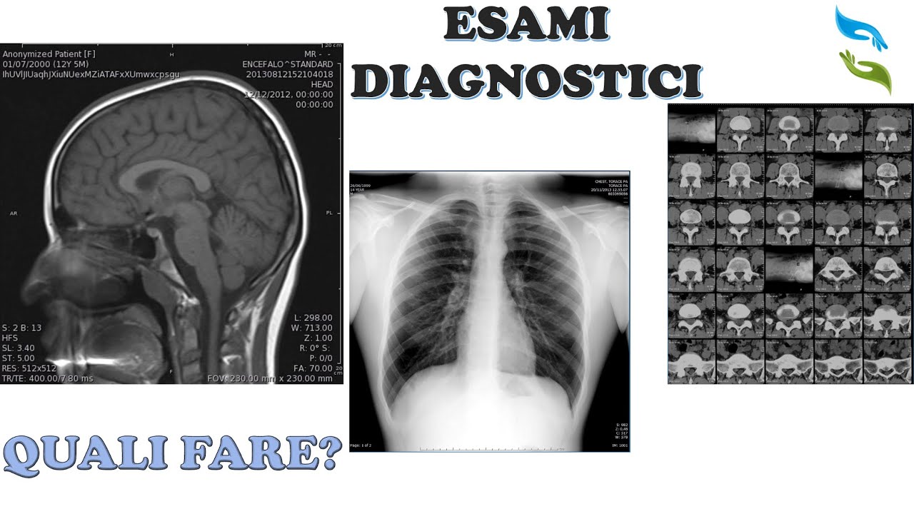 Watch Now Esami strumentali (raggi x, risonanza magnetica, ecografia..) quando fare quali. Esami strumentali (raggi x, risonanza magnetica, ecografia..) quando fare quali.
