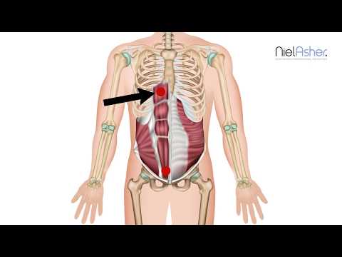 How To Find Trigger Points - Rectus Abdominis