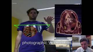 Introdução ao OsiriX