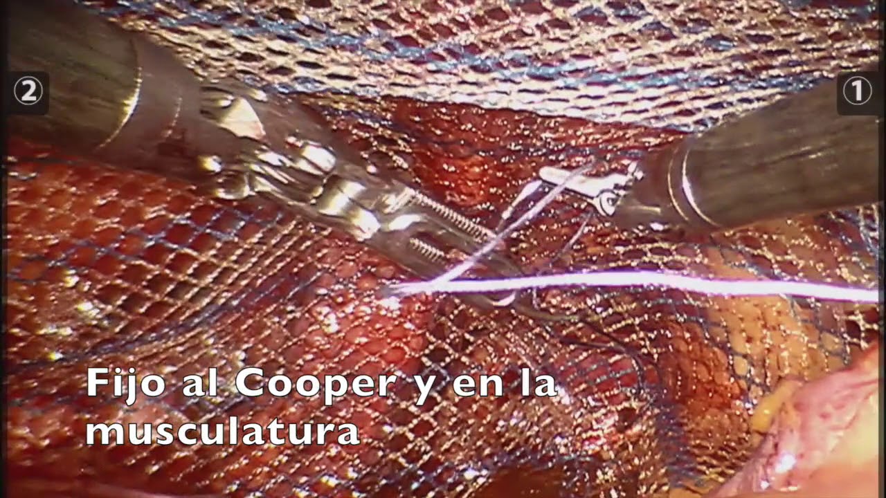 Olliver Núñez Cantú-15