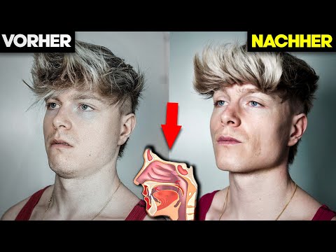 Meine MEWING Gesichtstraining Erfahrung! (attraktiveres Gesicht durch Zungenposition)