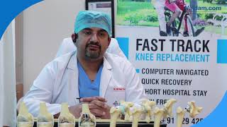 Fast Track Knee Replacement Surgery Faridabad, AIMS, doktor. Mrinal Sharma tomonidan tavsiflaydi