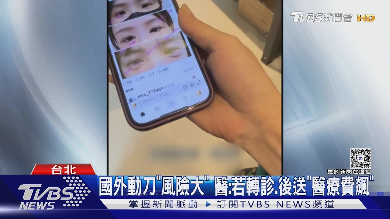 網紅推上海醫美釀禍?女花12萬術後「眼下腫脹」求救台醫