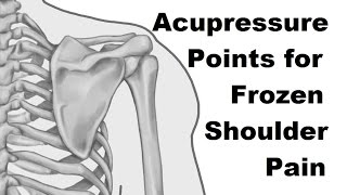 Acupresure Points for Frozen Shoulder Pain - Massage Monday #267
