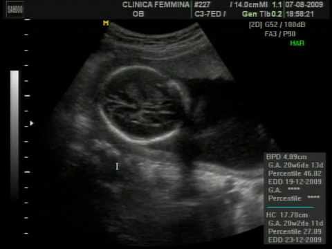 Nosso primeiro bebê (Gisele e Ezequiel)