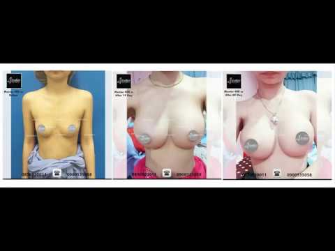 หน้าอกขนาดเล็กที่มีสื่อลามกรัศมีขนาดใหญ่ ไดแอน-35 เพื่อเพิ่มหน้าอก