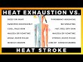 HEAT EXHAUSTION VS HEAT STROKE TOOLBOX TALK By Ally Safety