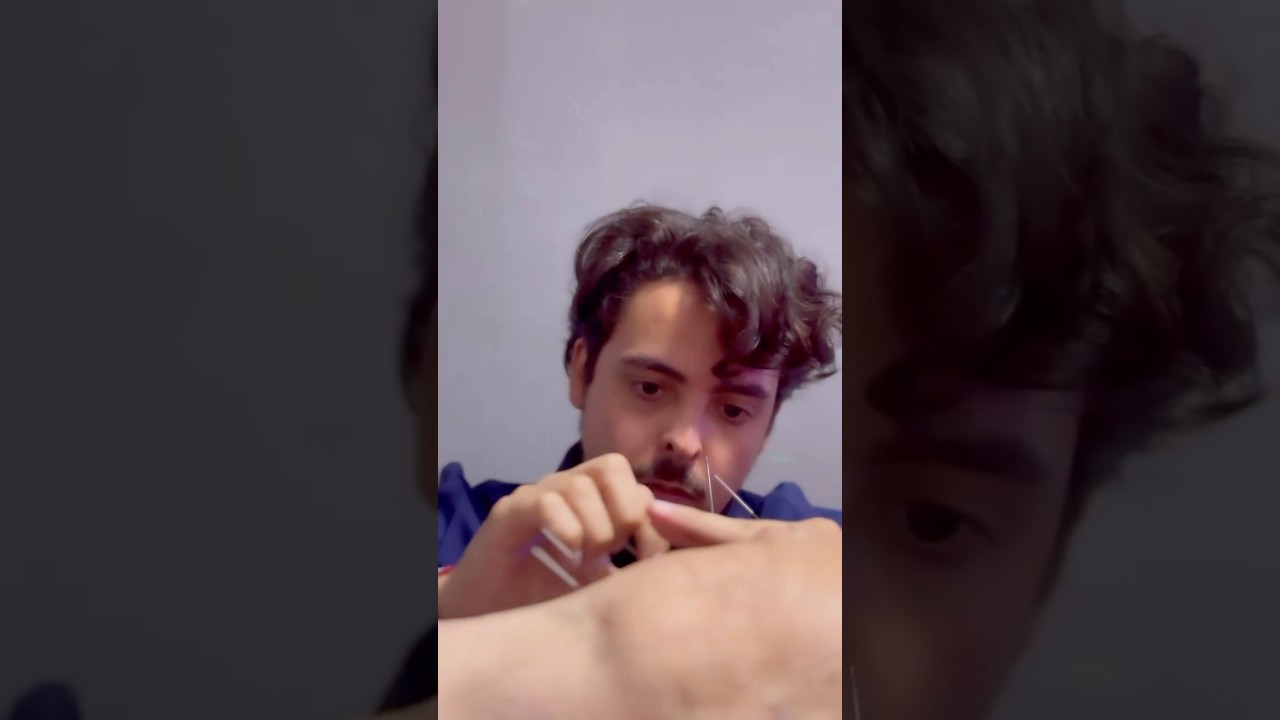 Como é uma experiência de acupuntura avançada? #acupuntura #alíviodador #quiropraxia #seitai