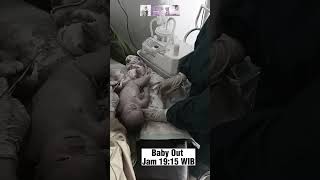 Download lagu Perjuangan Ibu Melahirkan Normal Bayi Malposisi Kayang #birthvlog mp3