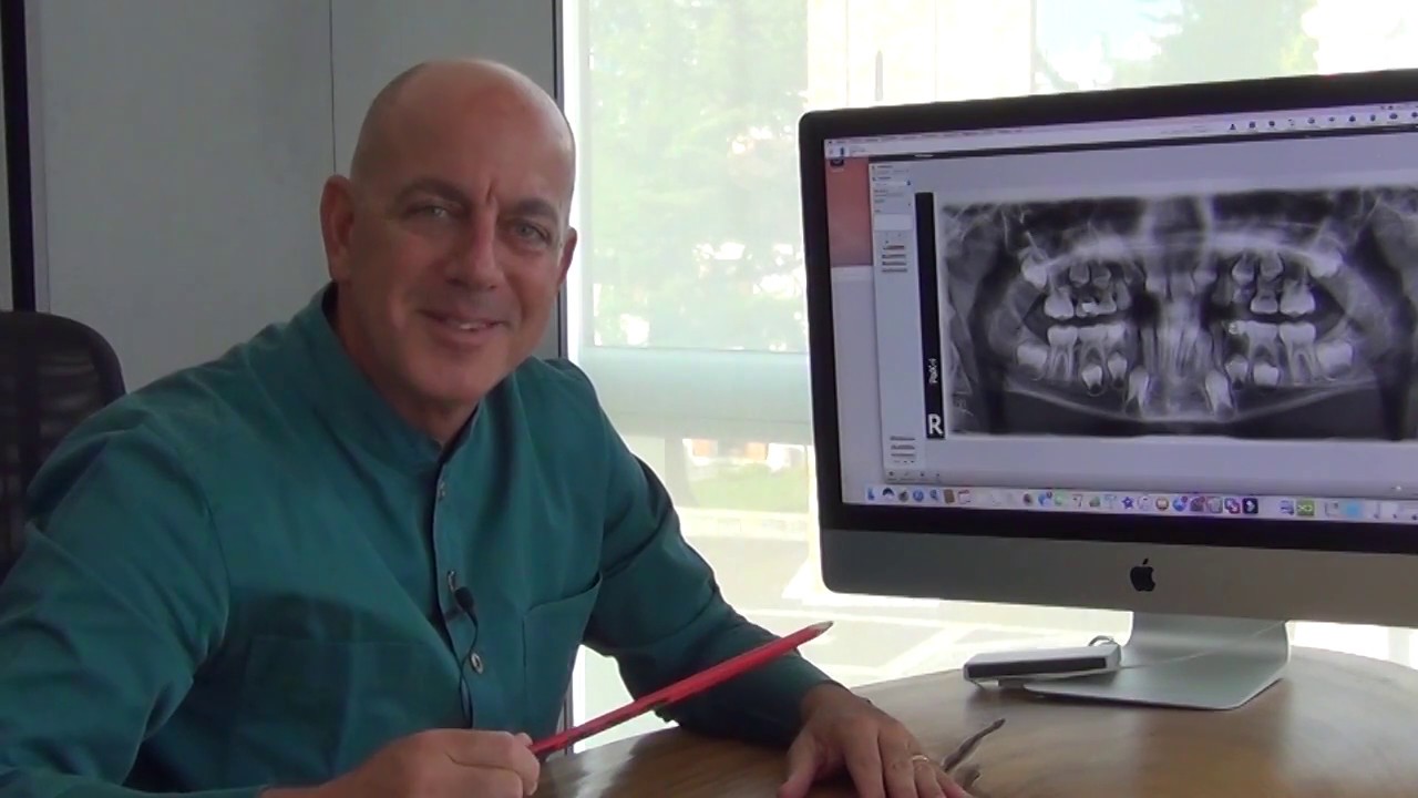 Watch Now Come crescono i dentini dei tuoi bambini Come crescono i dentini dei tuoi bambini