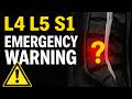 WARNING These Are The 3 MAJOR Symptoms Of A Severe L4 L5 L5 S1 Disc Bulge Dr Walter Salubro