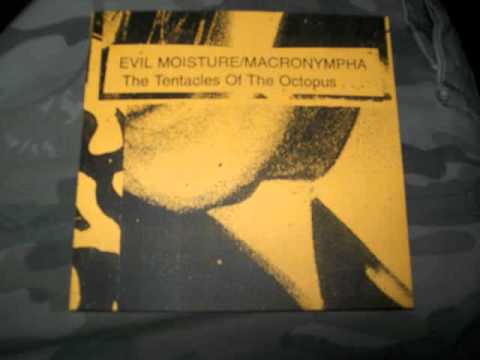 Macronympha/Evil Moisture - Junk Dissection/Anal Arsehol