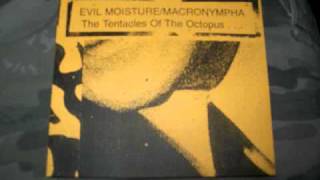 Macronympha/Evil Moisture - Junk Dissection/Anal Arsehol