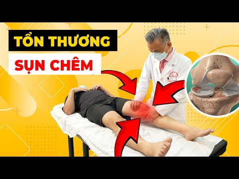 Tổn Thương Sụn Chêm Độ 3 Có Cần Thay Khớp Gối? Đừng Để Nỗi Lo Làm Lo Lắng!