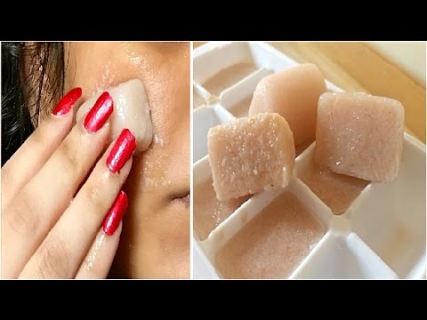 I'm SHOCKED it removed my Dark Spots in 3 Days Potato juice + lemon juice icecubes Skin Whitening