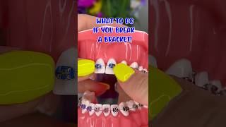 WHAT TO DO IF YOU BREAK A BRACKET / BRACES OFF TIPS 🦷 IF WAX DOESN'T WORK ORTHODONTIST REACTS
