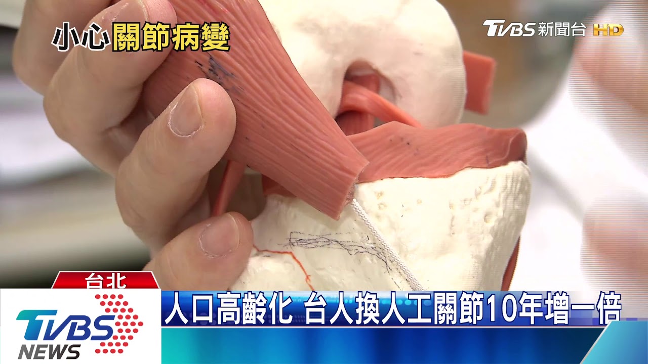 WHO列關節病變為「殺手級」 台7成人「關節痛」