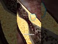 The Biology Of A Heart Attack