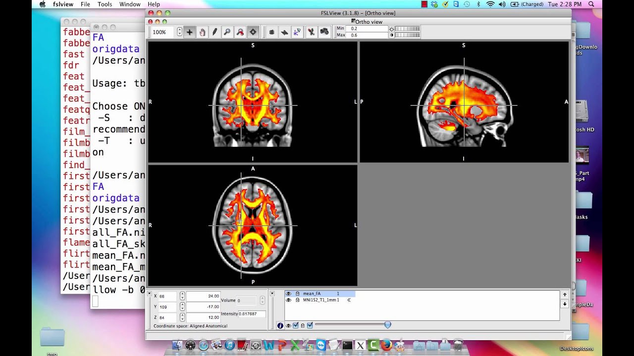 DTI Analysis, Steps 6&7: TBSS (Part 2)