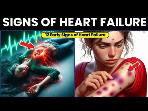 12 Early Signs of Heart Failure You Shouldn’t Ignore!
