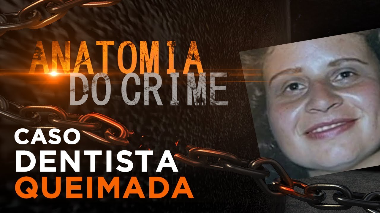 ANATOMIA DO CRIME - DENTISTA QUEIMADA VIVA