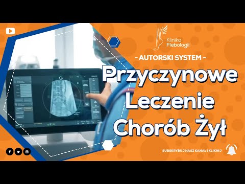PRZYCZYNOWE LECZENIE CHORÓB ŻYŁ - KLINIKA FLEBOLOGII