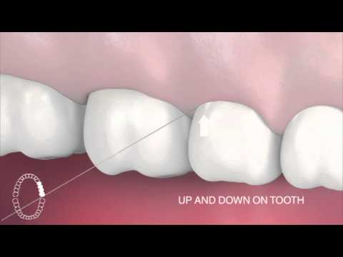 How to use interdental floss