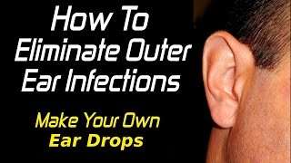 EASILY Treat Swimmer's Ear/Outer Ear Infections WITHOUT Prescription Drugs