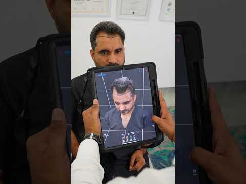 MedLinks Patient Hair Transplant Journey