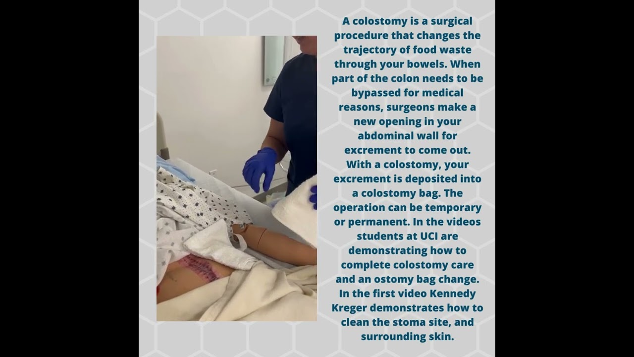 Colostomy Care Demonstration