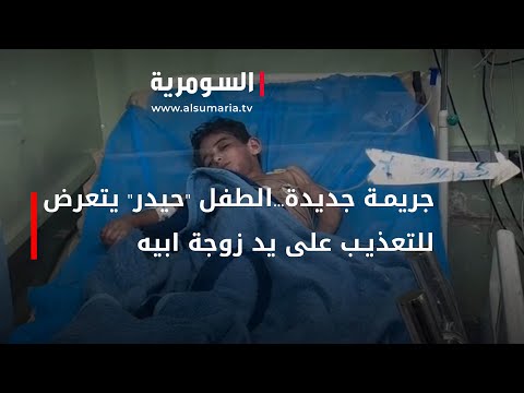 شاهد بالفيديو.. جريمة جديدة...الطفل حيدر يتعرض لشتى انواع التعذيب على يد زوجة ابيه