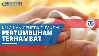 Sindrom Costello, Kelainan Genetik Ditandai Pertumbuhan dan Perkembangan Mental yang Terhambat