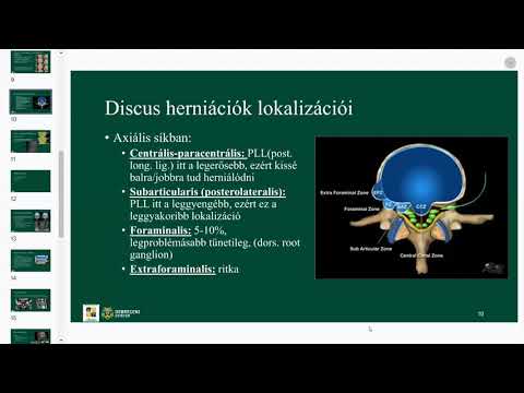 jó gyógyszer a nyaki csontritkulás kezelésére mely krém jó az ízületekre