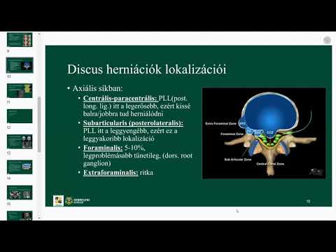 Rheumatoid arthritis kenőcs