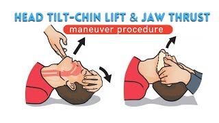 Jaw thrust & Head tilt - Chin lift | maneuver Explanation video