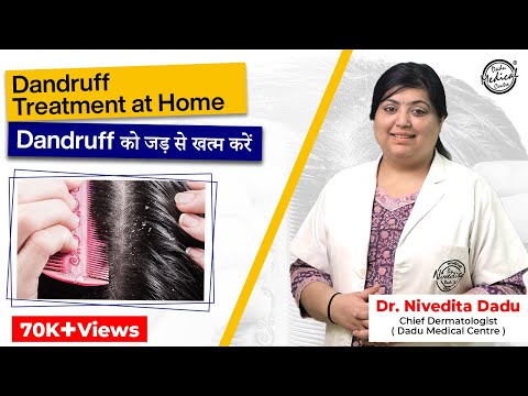Dandruff Removal Treatment at Home | Get Rid Of Flaky Scalp And Dandruff | Home Remedies