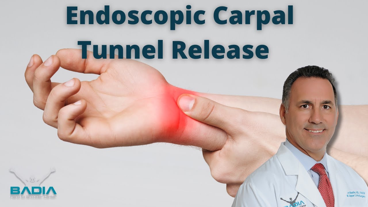 Endoscopic carpal tunnel release with Dr. Badia