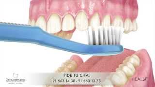 Limpieza dental - Recomendaciones