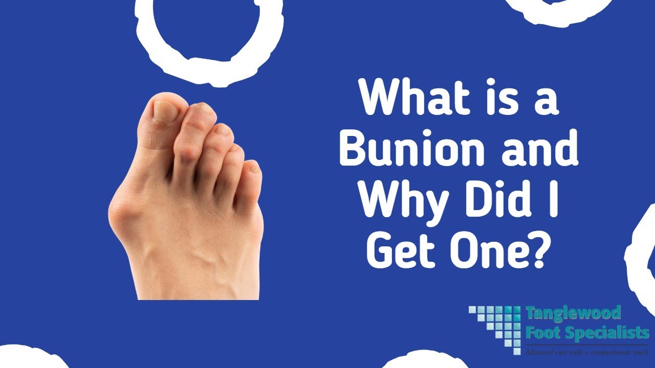 Houston podiatrist bunion specialist Painful bump on foot