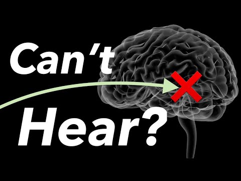 Top 10 Hearing Loss FACTS You Never Knew(Top 10 Hearing Loss FACTS You Never Knew)