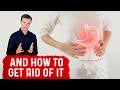 What Causes Gastritis